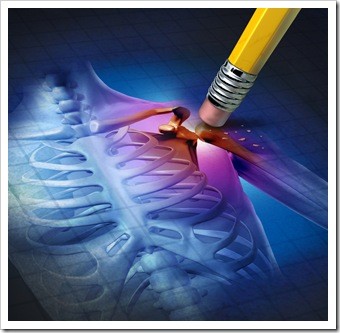 Scar Tissue Somerset NJ Chiropractic